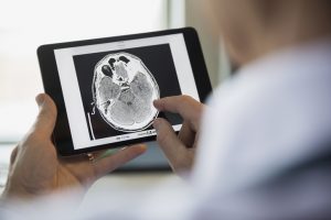 Doctor examining CT scan on digital tablet